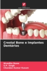 Image for Crestal Bone e Implantes Dentarios