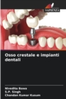 Image for Osso crestale e impianti dentali