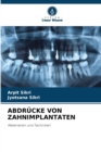 Image for Abdrucke Von Zahnimplantaten