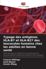 Image for Typage des antigenes HLA-B7 et HLA-B27 des leucocytes humains chez les adultes en bonne sante