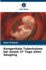 Image for Kongenitale Tuberkulose bei einem 37 Tage alten Saugling