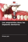 Image for Les empreintes dans les implants dentaires