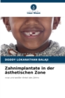 Image for Zahnimplantate in der asthetischen Zone