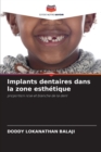 Image for Implants dentaires dans la zone esthetique