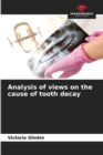Image for Analysis of views on the cause of tooth decay