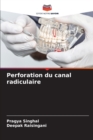 Image for Perforation du canal radiculaire