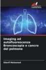 Image for Imaging ad autofluorescenza Broncoscopia e cancro del polmone