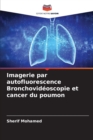 Image for Imagerie par autofluorescence Bronchovideoscopie et cancer du poumon