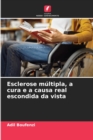 Image for Esclerose multipla, a cura e a causa real escondida da vista