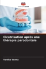 Image for Cicatrisation apres une therapie parodontale