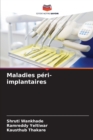 Image for Maladies peri-implantaires