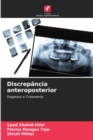 Image for Discrepancia anteroposterior