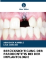 Image for Berucksichtigung Der Parodontitis Bei Der Implantologie