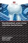 Image for Manifestation orale d&#39;une infection bacterienne