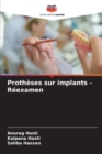 Image for Protheses sur implants - Reexamen