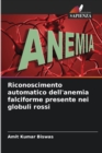 Image for Riconoscimento automatico dell&#39;anemia falciforme presente nei globuli rossi