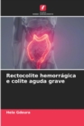 Image for Rectocolite hemorragica e colite aguda grave