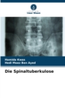 Image for Die Spinaltuberkulose