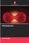 Image for Metastases
