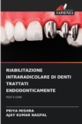 Image for Riabilitazione Intraradicolare Di Denti Trattati Endodonticamente