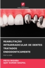 Image for Reabilitacao Intrarradicular de Dentes Tratados Endodonticamente