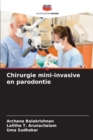Image for Chirurgie mini-invasive en parodontie