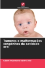 Image for Tumores e malformacoes congenitas da cavidade oral