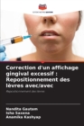 Image for Correction d&#39;un affichage gingival excessif