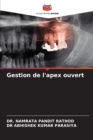 Image for Gestion de l&#39;apex ouvert