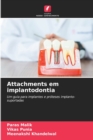 Image for Attachments em implantodontia