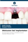 Image for Okklusion bei Implantaten