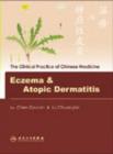 Image for Eczema and Atopic Dermatitis