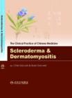 Image for Scleroderma and Dermatomyositis