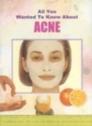 Image for All You Wanted to Know About Acne