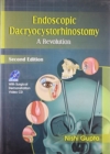 Image for Endoscopic Dacryocystorhinostomy