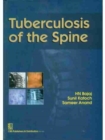 Image for Tuberculosis of the Spine