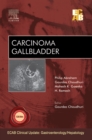 Image for Carcinoma Gallbladder - ECAB
