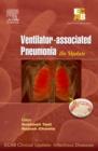 Image for ECAB Clinical Update - Ventilator-associated Pneumonia