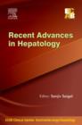 Image for ECAB Recent Advances in Hepatology