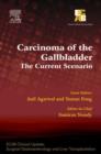 Image for Carcinoma of the Gallbladder: The Current Scenario - ECAB.