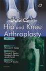 Image for Basics in hip and knee arthroplasty