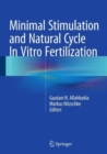 Image for Minimal Stimulation and Natural Cycle In Vitro Fertilization