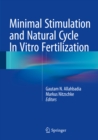 Image for Minimal Stimulation and Natural Cycle In Vitro Fertilization