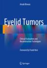 Image for Eyelid tumors  : clinical evaluation and reconstruction techniques