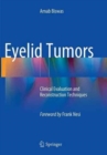 Image for Eyelid Tumors : Clinical Evaluation and Reconstruction Techniques