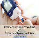 Image for Interventions and Procedures of Endocrine System and Skin
