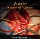 Image for Vascular Surgeries and Procedures