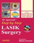 Image for Step by Step Lasik Surgery