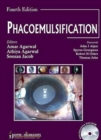 Image for Phacoemulsification Surgery : A Practical Approach