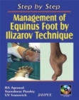 Image for Step by Step: Management of Equinus Foot by Ilizarov Technique